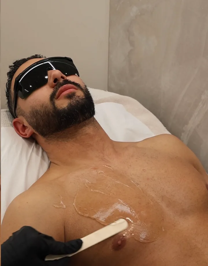 Épilation laser du torse chez un homme chez Oraskin : patient portant des lunettes de protection pendant la séance