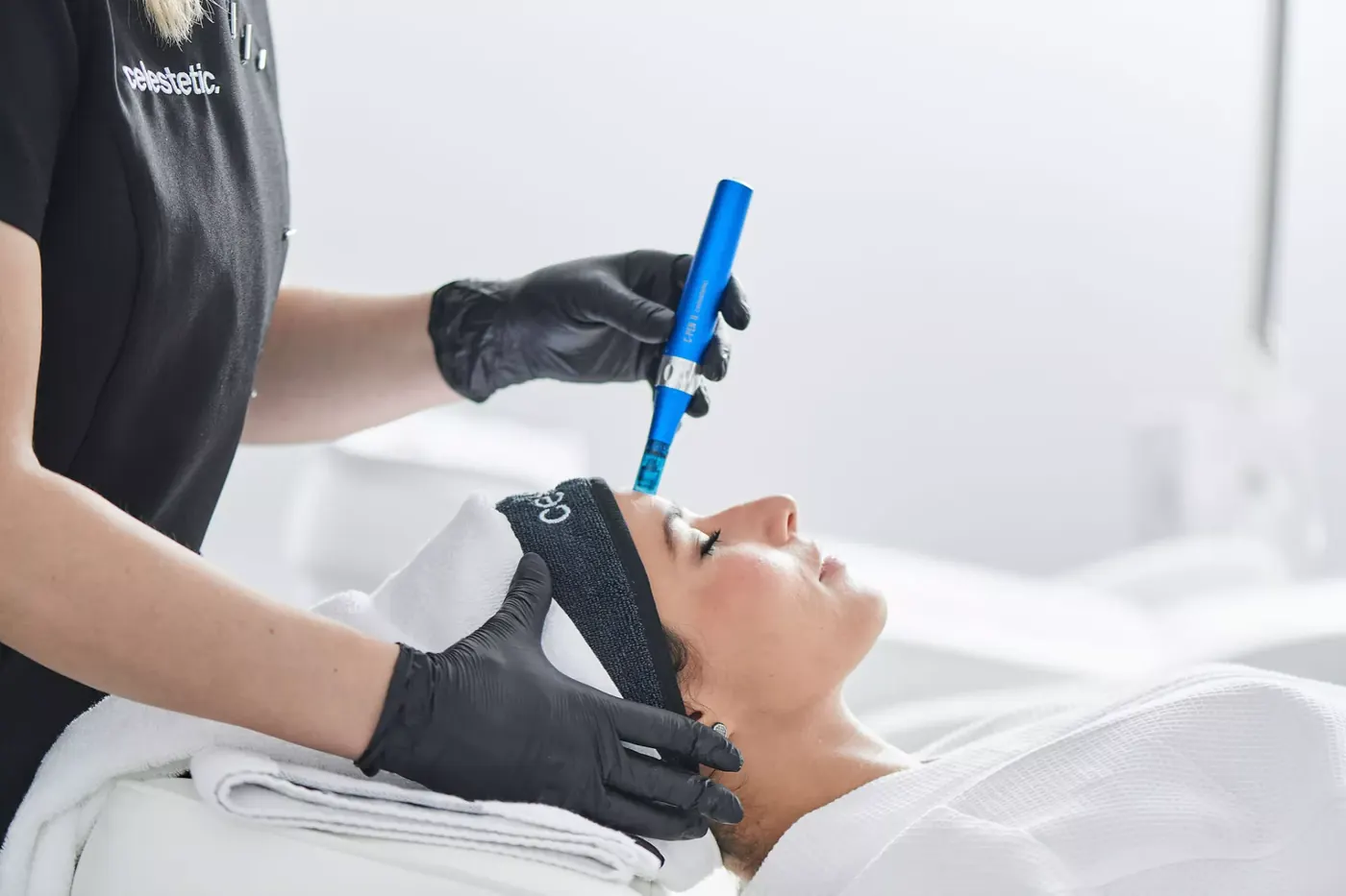 Séance de microneedling en institut : stylo à micro-aiguilles stériles appliqué sur le front par une praticienne gantée