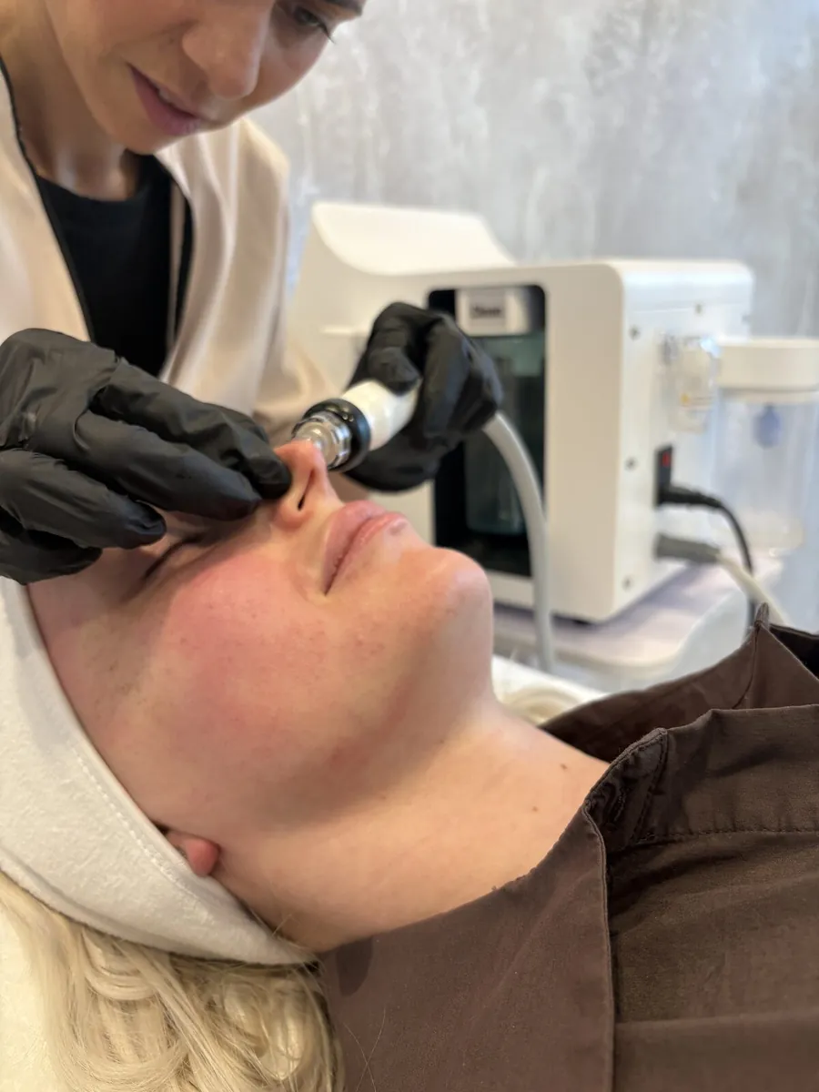 Soin Hydraskin en cabine chez Oraskin : embout d'aspiration passé sur le visage par une praticienne gantée
